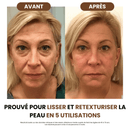 Brosse de drainage lymphatique Galerie