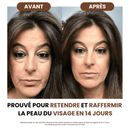 Brosse de drainage lymphatique Galerie